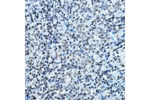 Immunohistochemistry of paraffin-embedded rat spleen using K Rabbit pAb (ABIN6128005, ABIN6142689, ABIN6142690 and ABIN6221516) at dilution of 1:100 (40x lens).