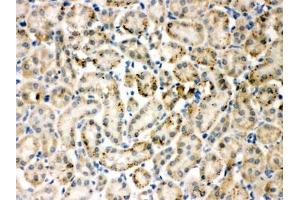 IHC-P testing of TIMP4 antibody and rat kidney tissue