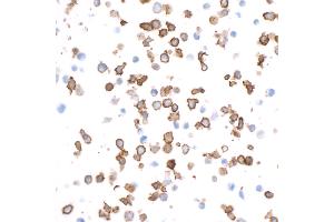 Immunocytochemistry (ICC) image for anti-Integrin alpha M (ITGAM) (AA 17-334) antibody (ABIN7453958)