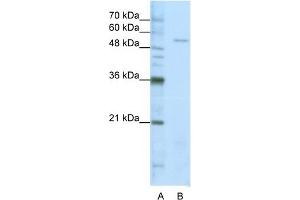 WB Suggested Anti-SARS Antibody Titration:  1. (Seryl-tRNA Synthetase (SARS) (Middle Region) anticorps)