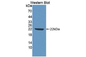 Western blot analysis of the recombinant protein. (ECT2 anticorps  (AA 166-348))