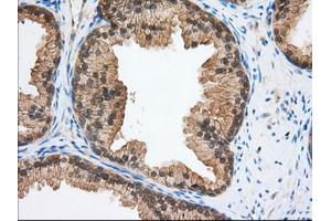 Immunohistochemistry (IHC) image for anti-Transforming, Acidic Coiled-Coil Containing Protein 3 (TACC3) antibody (ABIN1498098) (TACC3 anticorps)