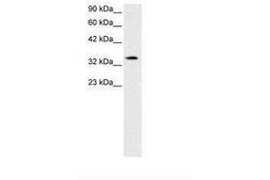 Image no. 2 for anti-PRKC, Apoptosis, WT1, Regulator (PAWR) (AA 212-261) antibody (ABIN202286) (PAWR anticorps  (AA 212-261))