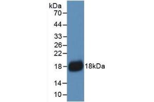 Detection of Recombinant IL18, Human using Monoclonal Antibody to Interleukin 18 (IL18) (IL-18 anticorps  (AA 37-193))