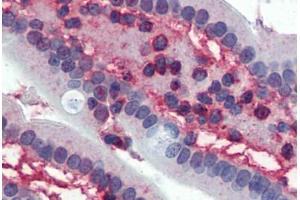 Small intestine,Human: Formalin-Fixed, Paraffin-Embedded (FFPE)