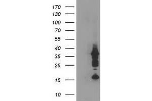Western Blotting (WB) image for anti-PDZ and LIM Domain 2 (PDLIM2) antibody (ABIN1500123) (PDLIM2 anticorps)