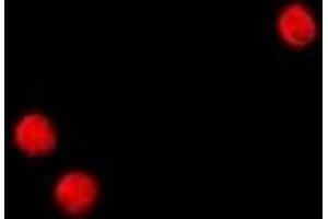 Immunofluorescent analysis of TSHZ2 staining in HeLa cells.