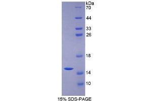 SDS-PAGE (SDS) image for Mucin 2, Oligomeric Mucus/gel-Forming (MUC2) (AA 5075-5179) protein (His tag) (ABIN1170965)