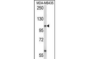 Western blot analysis of CASD1 Antibody (N-term) (ABIN652803 and ABIN2842526) in MDA-M cell line lysates (35 μg/lane). (CASD1 anticorps  (N-Term))