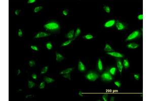 Immunofluorescence of monoclonal antibody to PEPD on HepG2 cell.