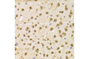 Immunohistochemistry of paraffin-embedded Mouse brain using RBFOX3 antibody at dilution of 1:100 (x400 lens). (NeuN anticorps)
