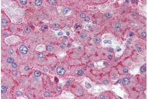 Human Liver (formalin-fixed, paraffin-embedded) stained with LRP1 antibody ABIN337070 at 5-10 ug/ml followed by biotinylated anti-mouse IgG secondary antibody ABIN481714, alkaline phosphatase-streptavidin and chromogen. (LRP1 anticorps)
