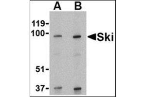 Western blot analysis of Ski in human kidney tissue lysate with this product at (A) 1 and (B) 2 μg/ml. (SKI anticorps  (N-Term))