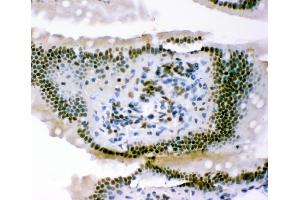 IHC analysis of p95 NBS1 using anti-p95 NBS1 antibody (ABIN3043282). (Nibrin anticorps  (C-Term))