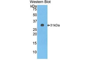 Western blot analysis of the recombinant protein. (Complement Factor H anticorps  (AA 915-1156))