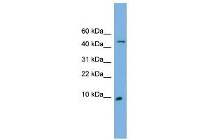 ENSA antibody used at 1 ug/ml to detect target protein. (Ensa anticorps  (N-Term))