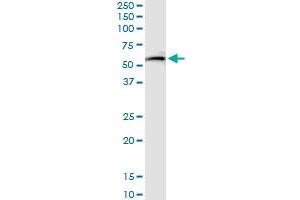 Immunoprecipitation of GSR transfected lysate using anti-GSR MaxPab rabbit polyclonal antibody and Protein A Magnetic Bead , and immunoblotted with GSR purified MaxPab mouse polyclonal antibody (B01P) .