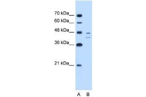 FAH antibody used at 2. (FAH anticorps)