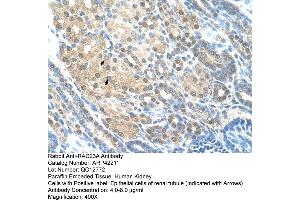Rabbit Anti-RAD23A Antibody  Paraffin Embedded Tissue: Human Kidney Cellular Data: Epithelial cells of renal tubule Antibody Concentration: 4. (RAD23A anticorps  (Middle Region))