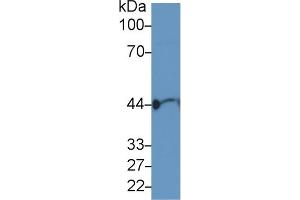 Detection of ACTG in Human Serum using Polyclonal Antibody to Gamma Actin (ACTG)