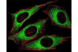 Fluorescent image of HeLa cells stained with FGFR2 antibody at 1:25 dilution. (FGFR2 anticorps  (AA 7-37))