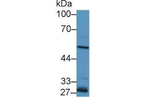 Detection of ALDH1A2 in Human Lung lysate using Polyclonal Antibody to Aldehyde Dehydrogenase 1 Family, Member A2 (ALDH1A2)