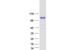 Validation with Western Blot