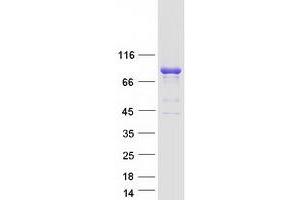 Validation with Western Blot (ARHGEF7 Protein (Transcript Variant 2) (Myc-DYKDDDDK Tag))