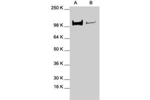 Western blot analysis of STAT2 polyclonal antibody  in expression in A-431 (A) and HeLa (B) whole cell lysates. (STAT2 anticorps  (C-Term))