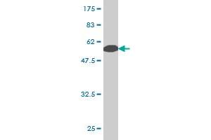 Western Blot detection against Immunogen (65. (PCBP2 anticorps  (AA 1-362))