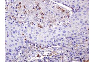 Image no. 2 for anti-Integrin alpha FG-GAP Repeat Containing 3 (ITFG3) antibody (ABIN1498916)