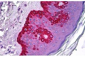 Human Skin: Formalin-Fixed, Paraffin-Embedded (FFPE) (CELA1 anticorps)