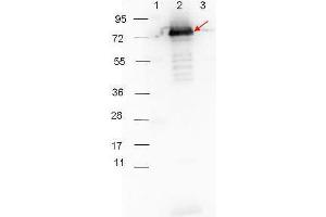 Western blot showing detection of 0. (Surface Lipoprotein p27 anticorps)