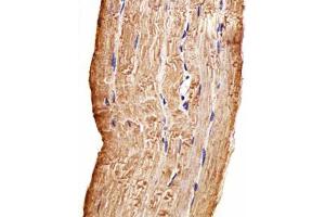 Immunohistochemical staining of formalin-fixed and paraffin-embedded human skeletal muscle section reacted with MAP4K3 monoclonal antibody  at 1:100 dilution. (MAP4K3 anticorps)