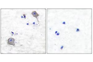 Immunohistochemical analysis of paraffin-embedded human brain tissue using Claudin 5 antibody (ABIN5976358). (Claudin 5 anticorps  (C-Term))