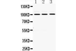 Western Blotting (WB) image for anti-RAS P21 Protein Activator (GTPase Activating Protein) 1 (RASA1) (AA 1018-1047), (C-Term) antibody (ABIN3043368) (RASA1 anticorps  (C-Term))