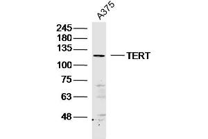 A375 lysates probed with TERT Polyclonal Antibody, Unconjugated  at 1:300 dilution and 4˚C overnight incubation. (TERT anticorps  (AA 601-750))