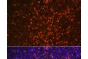 Immunofluorescence analysis of Human spleen using CR2 Polyclonal Antibody at dilution of 1:100 (40x lens). (CD21 anticorps)