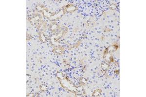 Immunohistochemistry (IHC) image for anti-ATG16 Autophagy Related 16-Like 1 (ATG16L1) (AA 90-300) antibody (ABIN1678769) (ATG16L1 anticorps  (AA 90-300))