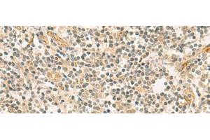 Immunohistochemistry of paraffin-embedded Human tonsil tissue using HHIPL2 Polyclonal Antibody at dilution of 1:55(x200) (HHIPL2 anticorps)