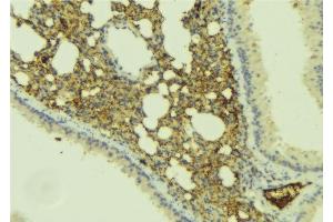 ABIN6277406 at 1/100 staining Mouse lung tissue by IHC-P. (MMP25 anticorps  (Internal Region))