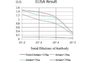 Black line: Control Antigen (100 ng),Purple line: Antigen (10 ng), Blue line: Antigen (50 ng), Red line:Antigen (100 ng)