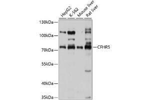 Western blot analysis of extracts of various cell lines, using CFHR5 antibody (ABIN6131938, ABIN6138459, ABIN6138460 and ABIN6214598) at 1:1000 dilution. (CFHR5 anticorps  (AA 450-569))