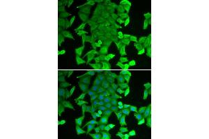 Immunofluorescence analysis of MCF-7 cell using RFFL antibody.