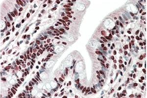ABIN1781995 (5µg/ml) staining of paraffin embedded Human Small Intestine.