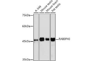 Western blot analysis of extracts of various cell lines, using RRP40 Rabbit mAb (ABIN7269816) at 1:1000 dilution. (RABEPK anticorps)