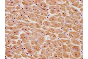 IHC image of ABIN7139700 diluted at 1:100 and staining in paraffin-embedded human heart tissue performed on a Leica BondTM system.
