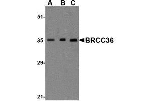 Western Blotting (WB) image for anti-BRCA1/BRCA2-Containing Complex, Subunit 3 (BRCC3) (N-Term) antibody (ABIN1031281) (BRCC3 anticorps  (N-Term))