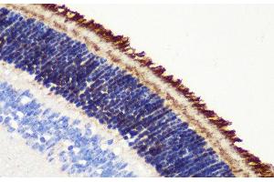 Immunohistochemistry of paraffin-embedded Mouse retina using PDE6B Polyclonal Antibody at dilution of 1:200 (40x lens). (PDE6B anticorps)