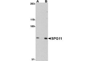 Western Blotting (WB) image for anti-Spastic Paraplegia 11 (Autosomal Recessive) (SPG11) antibody (ABIN1031796) (SPG11 anticorps)